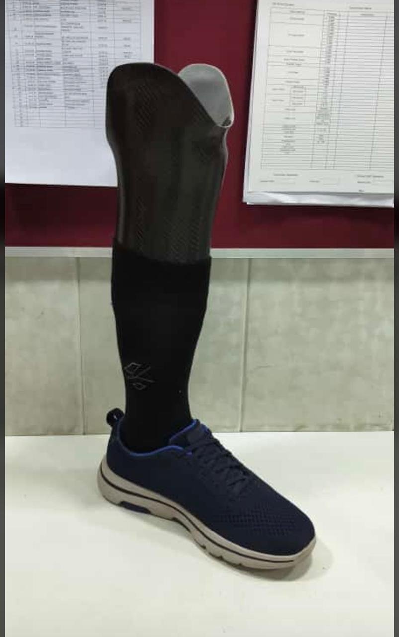 CARBONFIBER  BELOW KNEE  PROSTHETIC